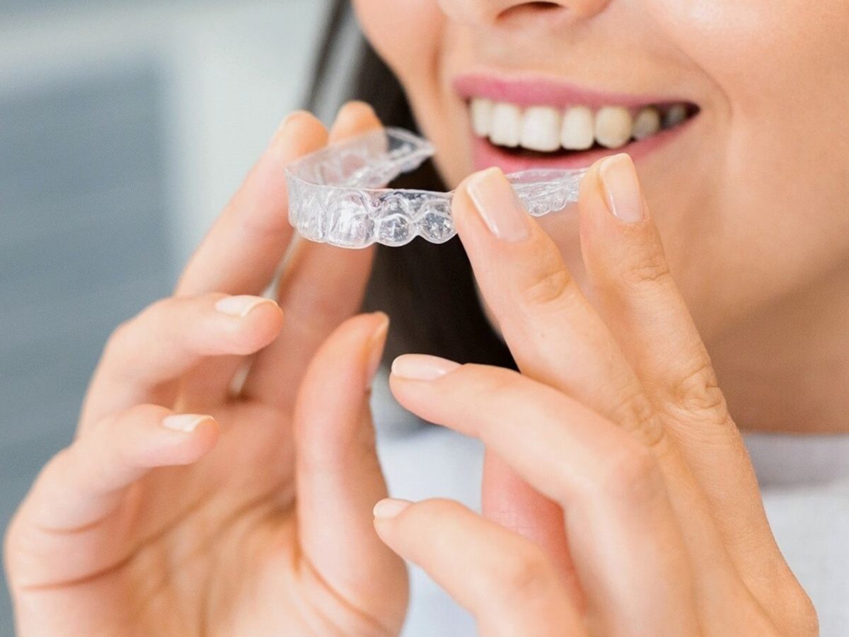 Complete Guide to Invisalign: How It Works