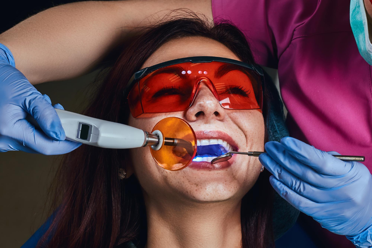 Laguna Niguel Teeth bleaching